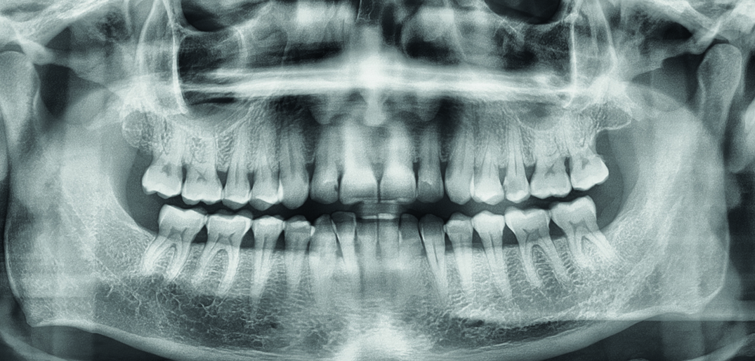 Teeth_xray.jpg