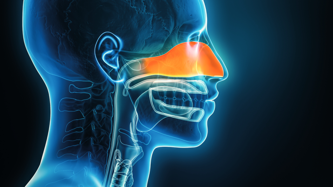 sinusitis-summary