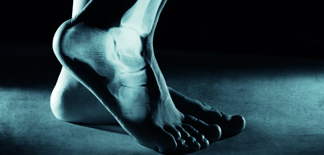 Feet_xray.jpg